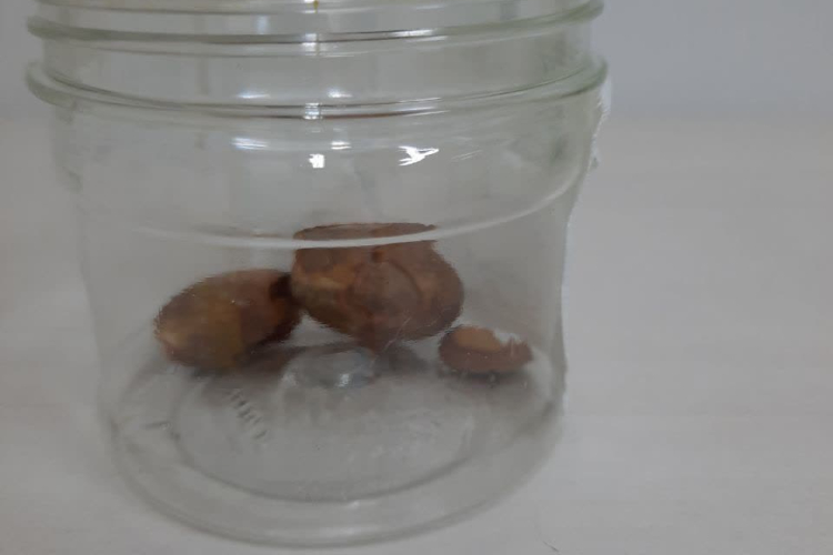 Specialized surgery to remove large bladder stones